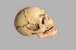 Totenkopf
