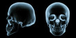Skull xray