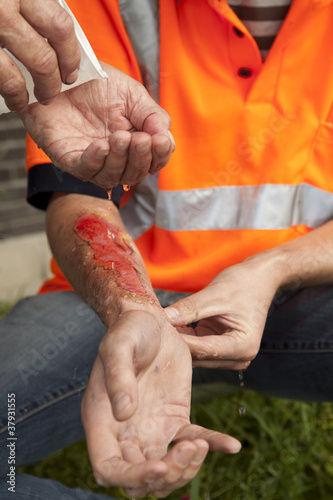 Photo: First aid. Accident at work. First aid. Accident at work.