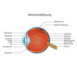 netzhaut ablösung deutsch vektor illustration