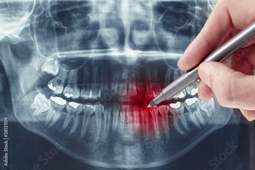 Foto: Dental xray Dental xray