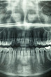 Foto: Dental xray, horror skull Dental xray, horror skull