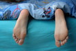 Woman feet with callus in a bed Woman feet with callus in a bed