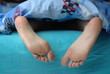 Female feet with callus Female feet with callus