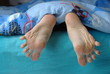Splayed female thumbs Splayed female thumbs