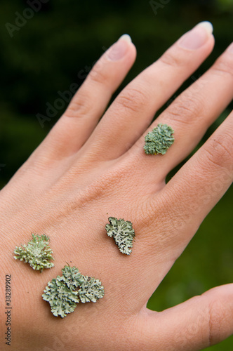 Photo: lichen on the hand lichen on the hand