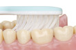 Mundhygiene