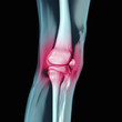 Bein mit Blick auf das rot eingefärbte Knie mit Gelenk