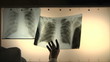 doctors regard chest x-ray