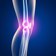 Knie-Schmerzen - 3D Grafik