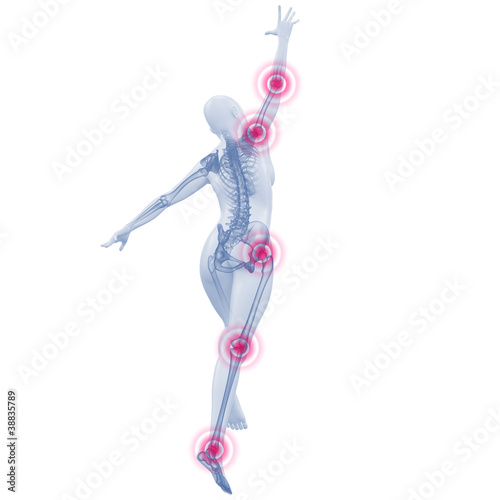 Illustration: Silhouette junger Frau mit Gelenkschmerzen Silhouette junger Frau mit Gelenkschmerzen