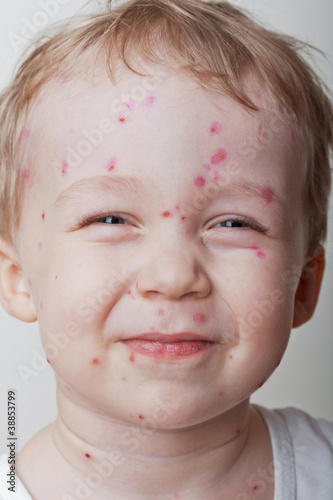 Photo: Disease Disease