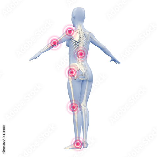 Illustration: Silhouette junger Frau mit Gelenkschmerzen Silhouette junger Frau mit Gelenkschmerzen