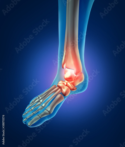 Illustration: Human Foot Pain Human Foot Pain