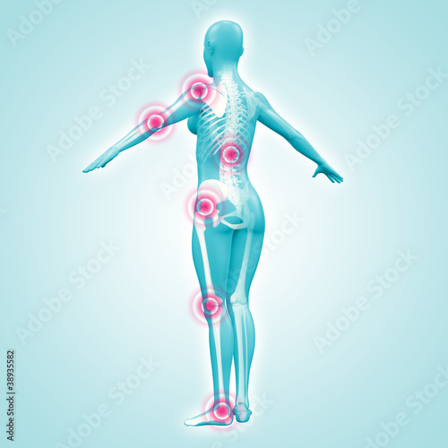 Illustration: Silhouette junger Frau mit Gelenkschmerzen Silhouette junger Frau mit Gelenkschmerzen