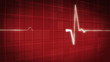 KG electrocardiogram pulse real waveform