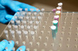 female hand holds a test tubes for PCR