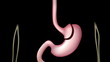 Roux-en-Y Gastric Bypass (RNY) surgery procedure