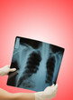 Two hands holding x-ray image of human body