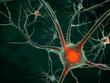 Cell body of a Neuron