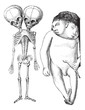 Fig. 174. Skeleton of two-headed monster derodyme. (Musee Dupuyt