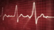 EKG electrocardiogram