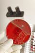 Medical Laboratory Assistent