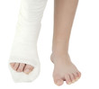 leg in a plaster cast