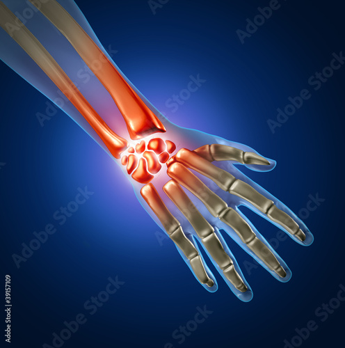 Illustration: Hand Pain Hand Pain