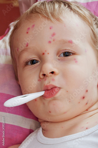 Photo: Portrait of a sick child Portrait of a sick child