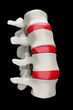 Spine on black