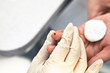 Blood test