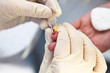 Blood test