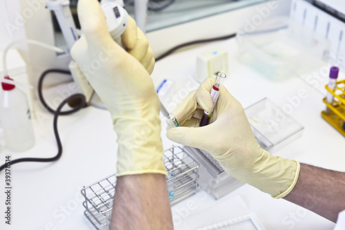 Photo: Blood test Blood test