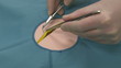 Surgeon  exercising stitching, starting a stitch