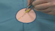 Surgeon exercising stitching, manually knotting