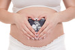Pregnant with photo of her Ultrasound