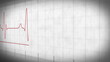 EKG electrocardiogram pulse real waveform on white paper