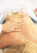 Woman receiving vacuum cupping massage treatment