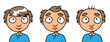 Man balding process