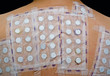 Photo: Skin Allergy Test Skin Allergy Test