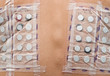 Photo: Skin Allergy Test Skin Allergy Test
