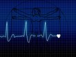 EKG