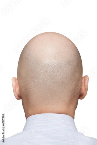 Photo: Bald man head Bald man head