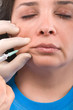 Cosmetic injection of botox to the adult female face