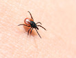 Ticks ​​on human skin.