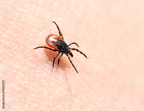 Photo: Ticks on human skin. Ticks on human skin.