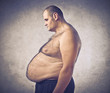 Overweight man