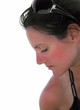 Sunburn Sunburn