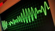 EKG Screen